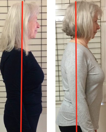 Photos of Eve Johnson showing the results of two years of Spinefulness, including a much straighter upper back.